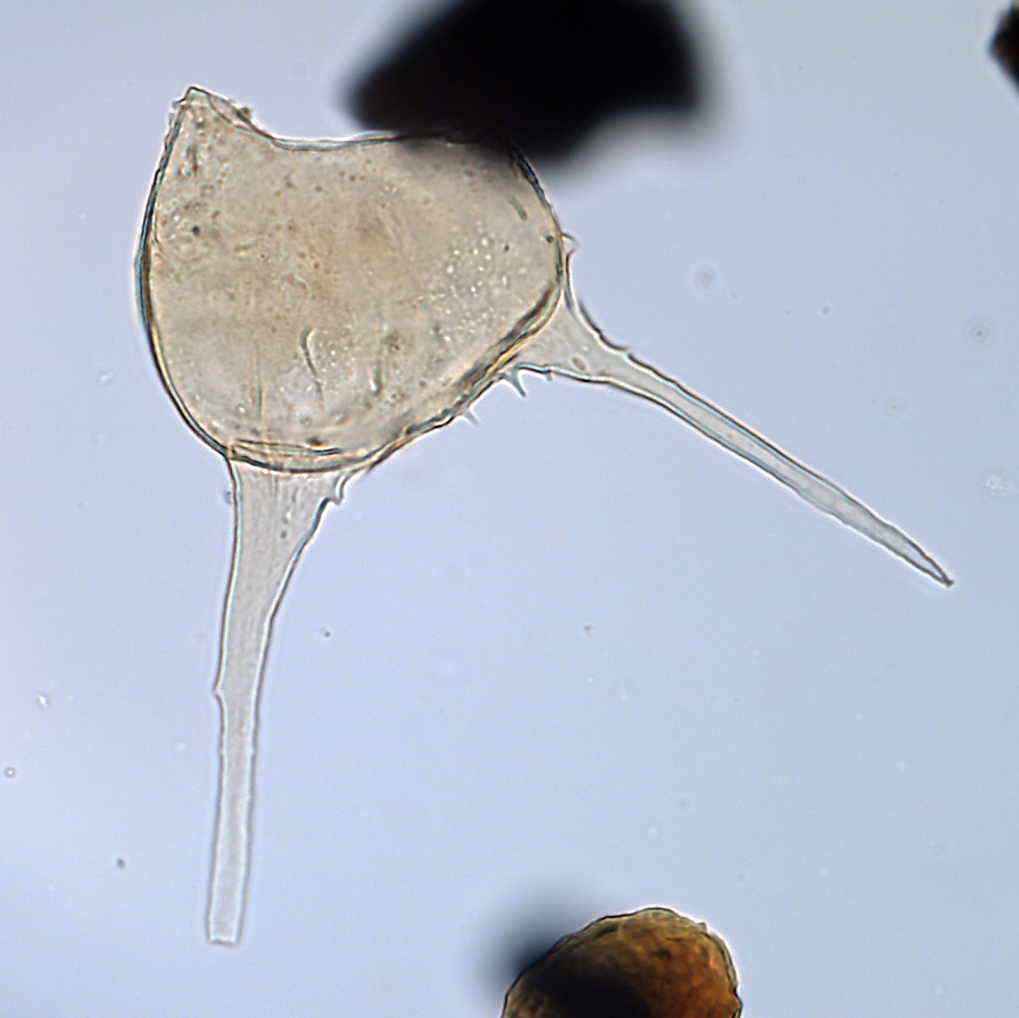 Odontochitina operculatum, U1581-30R-3W, 74-78, sl. 1, S28-1, foto-b.jpg